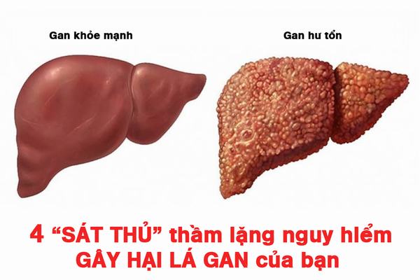 nguyên nhân gây hai gan
